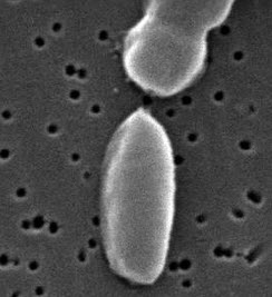 Vibrio parahaemolyticus