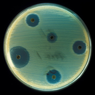 microorganismos Staphylococcus leche cruda